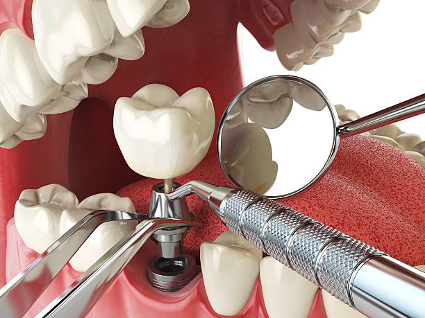 Best Emergency Denture Repair in Blair, NE